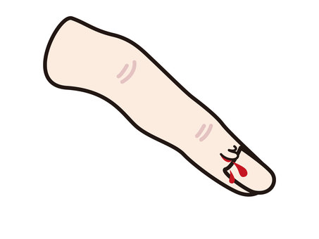 さかむけ