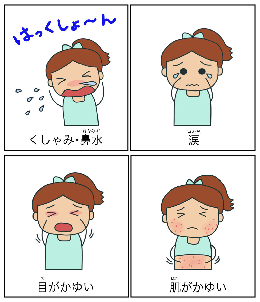 【花粉症】舌下免疫療法！